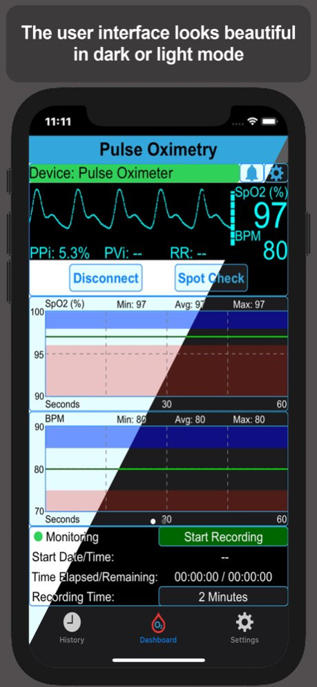 Pulse Oximetry 1.19.1 Screenshot