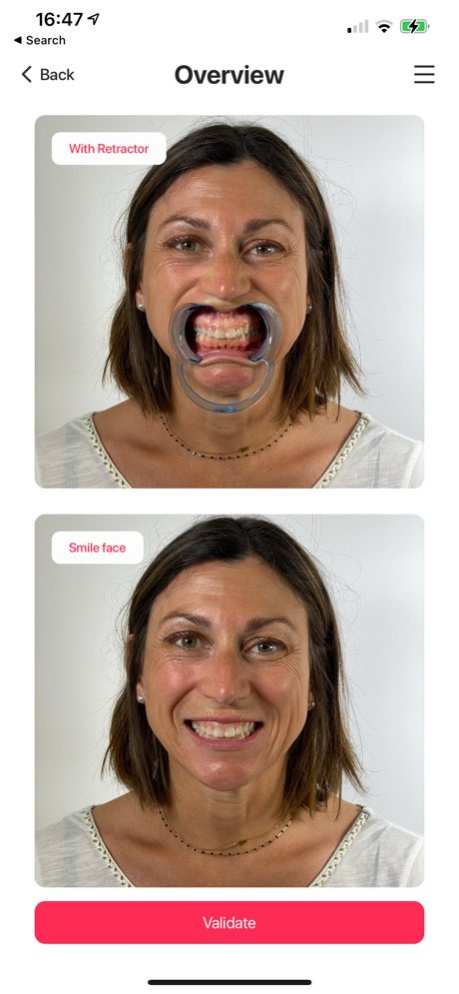 Smile+ 1.4.3 Screenshot